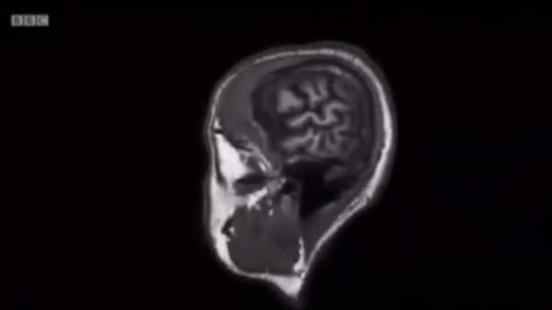 How junk food alters the neural connections in your brain, after only 4 weeks on the Matrix diet, leading to a decline in cognitive abilities, aka dumbing you down.