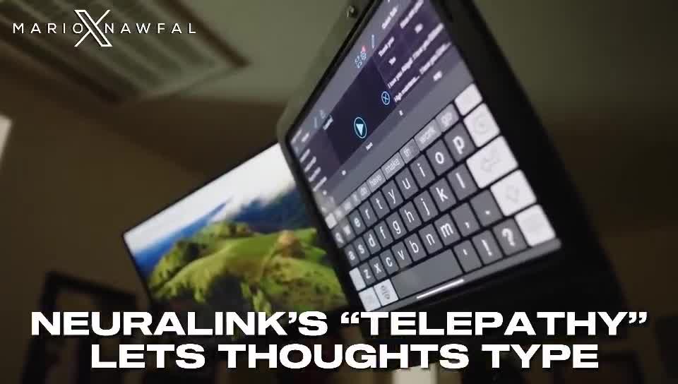 NEURALINK’S “TELEPATHY” LETS THOUGHTS TYPE - NO HANDS NEEDED  Twenty years paralyzed…now she’s typing with her mind elatedly!  Neuralink’s brain tech just made the impossible fee...