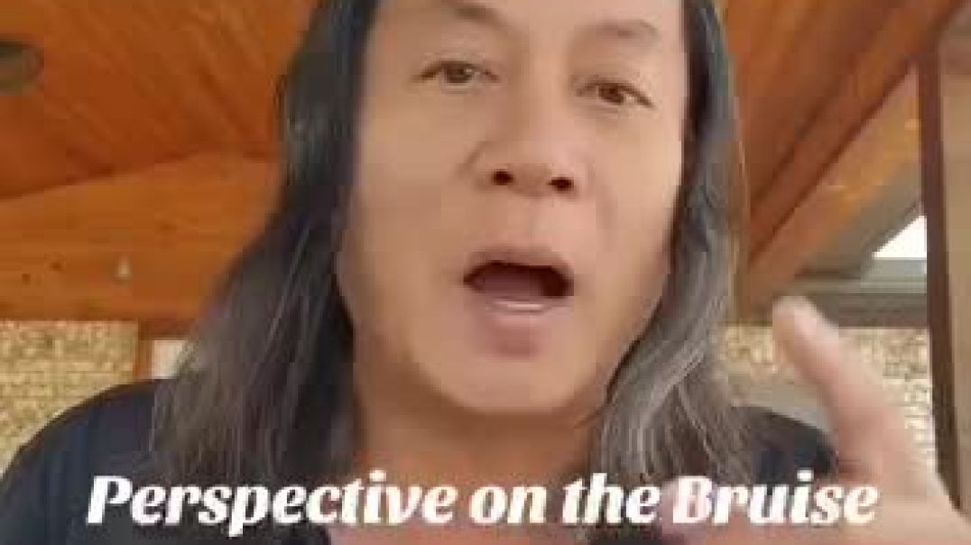 Gene Ho: Perspective on the Bruise on Pres. Trump's hand..