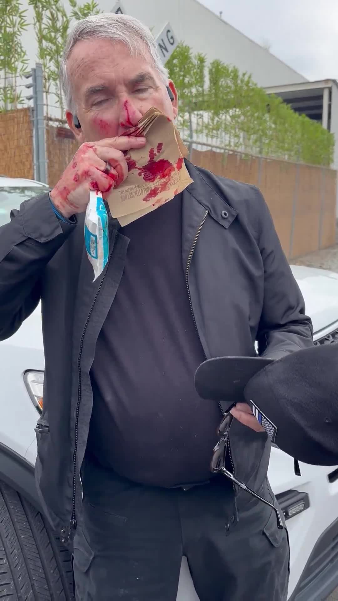 A security guard working with a news station was attacked by anti-ICE terrorists in California They slashed his face and chipped his tooth Newscum’s policies empower lunatic leftists to...