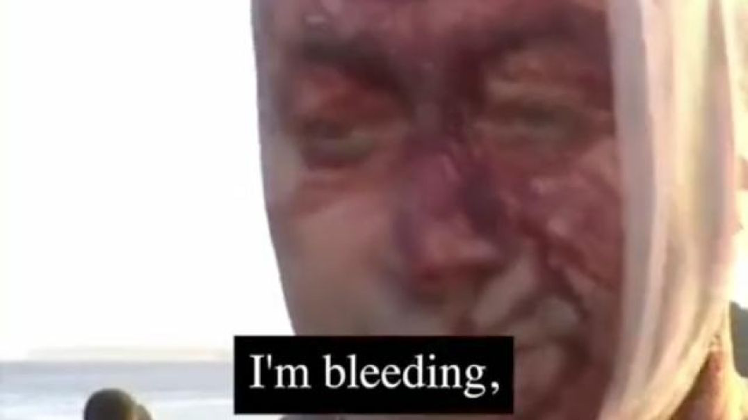 False flags to manipulate retarded goyim bondi