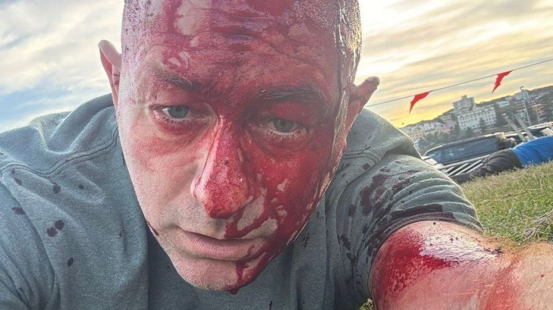 ❗️At least 12 KILLED in Bondi Beach MASSACRE — New South Wales Premier  Confirms 1 of suspected shooters killed, 1 detained